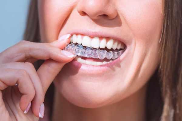 orthodontist Hartlepool