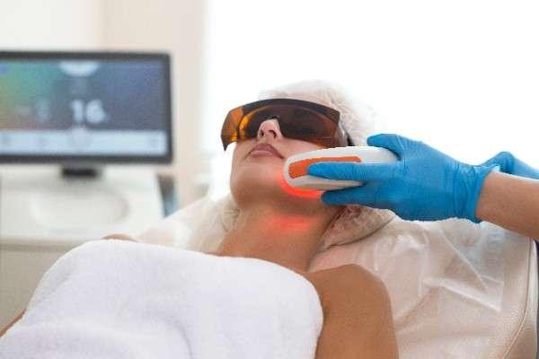 Laser Hair Removal in Barnstaple